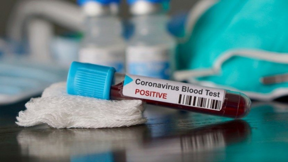 Rumıniyada koronavirusun qurbanları çoxalır