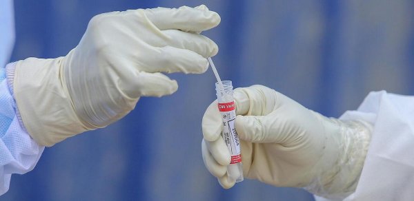 Rusiyada koronavirusdan sağalanların sayında rekord qeydə alınıb