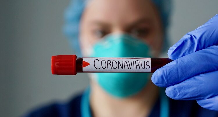 Gürcüstanda koronavirusa yoluxanların sayı 652 mini keçib