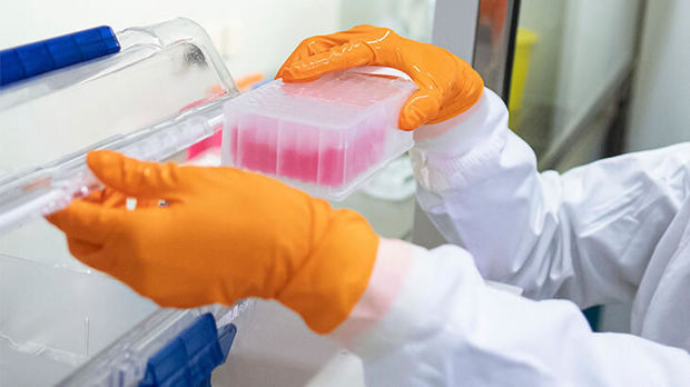 Türkiyə laboratoriyalarında koronavirus test nəticələri gizlədilib