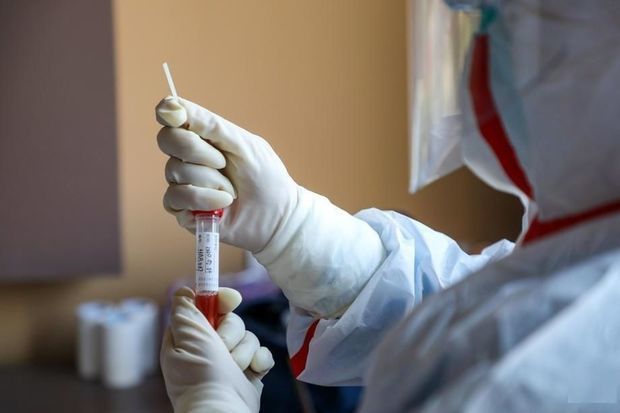 Rusiyada koronavirusu 15-20 dəqiqəyə müəyyən edən sistem təqdim edildi