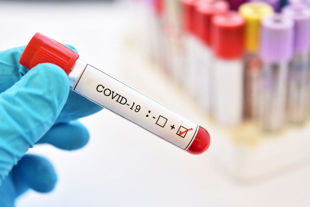 Azərbaycanda daha bir nəfər koronavirusdan öldü, 33 yeni yoluxma aşkarlandı - VİDEO