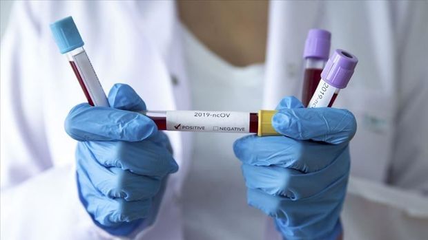 ABŞ-da son sutkada 200 min insan koronavirusa yoluxdu